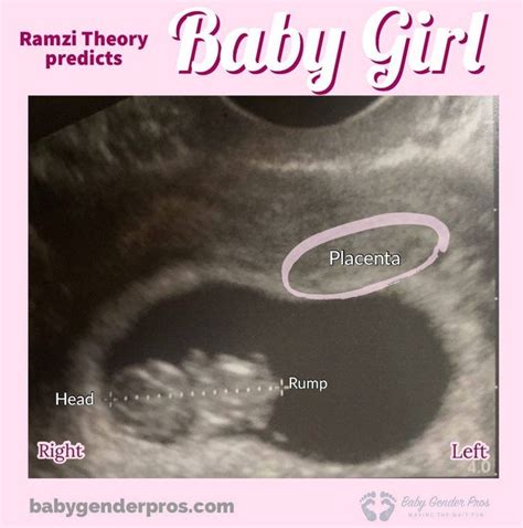 Ramzi Theory Week By Week Baby Gender Pros Consejos Para El