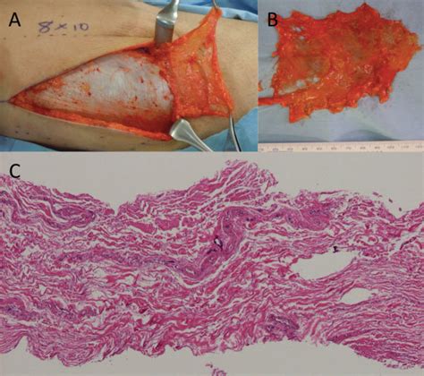 Areolar Connective Tissue