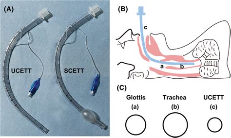 The Schematic Of Modified Adult Ucett And Anatomical Characteristics