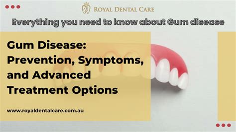 Ppt Gum Disease Prevention Symptoms And Advanced Treatment Options Powerpoint Presentation