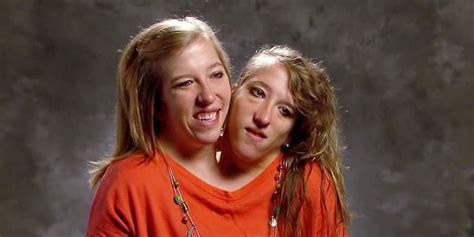 Meet Conjoined Twins Brittany And Abby Hensel Minh Khang Cente