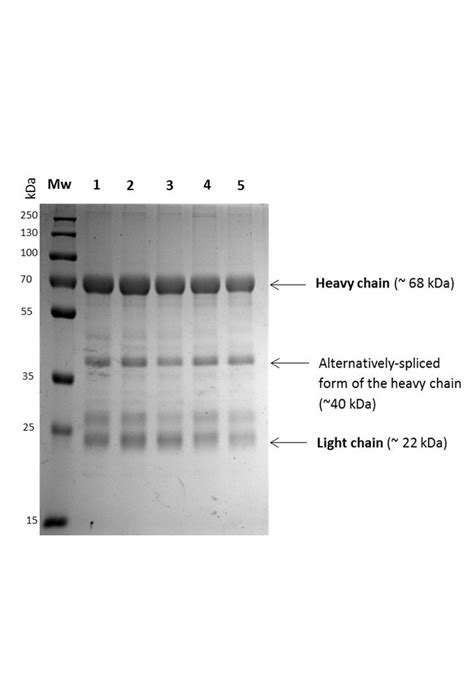 Why Am I Getting Bands For The Light Chain Of An Antibody On A Sds