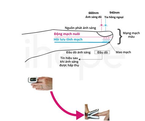 Đo độ bão hòa oxy máu trong mạch ngoại vi ihope