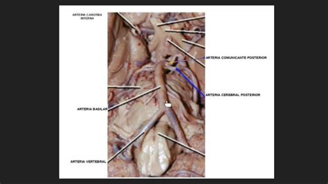 Polígono de Willis Anatomía Bosque uDocz