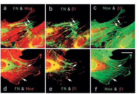 Figure 4 From Dual Labeling Of The Fibronectin Matrix And Actin