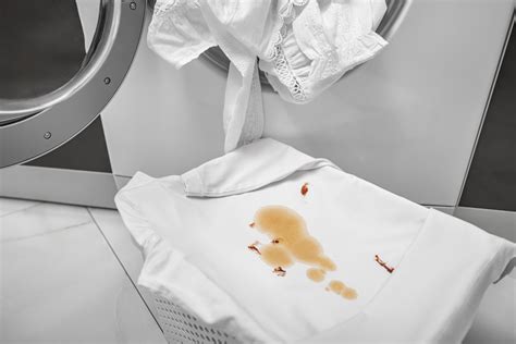 Corrimento Que Mancha A Roupa - Como tirar manchas das roupas de forma simples e eficaz - Semorin