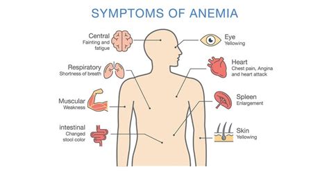 Vitamin B12 Deficiency Causes Which Type Of Anemia At Jamie Heyne Blog