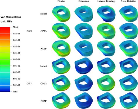 Frontiers Biomechanical Evaluation Of A Novel Individualized Zero