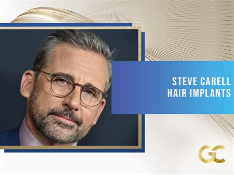 Steve Carell Hair Implants - Acıbadem Best Hair Transplant Turkey