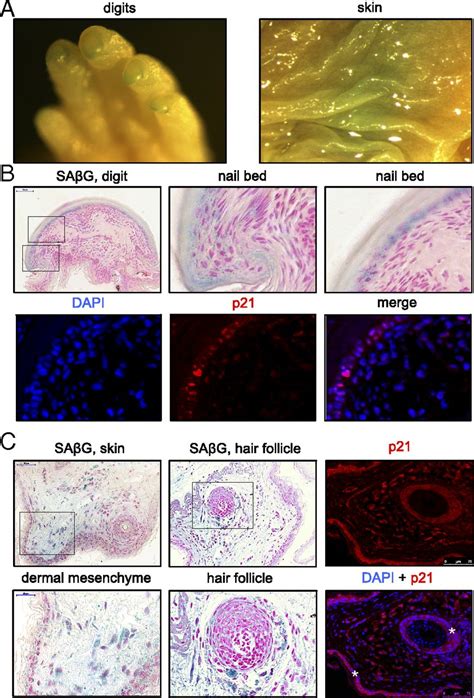 Naked Mole Rats Can Undergo Developmental Oncogene Induced And Dna