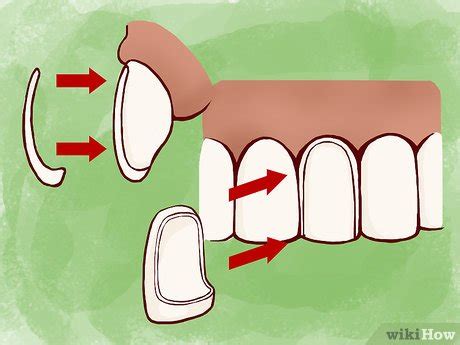 3 Ways To Strengthen Tooth Enamel WikiHow