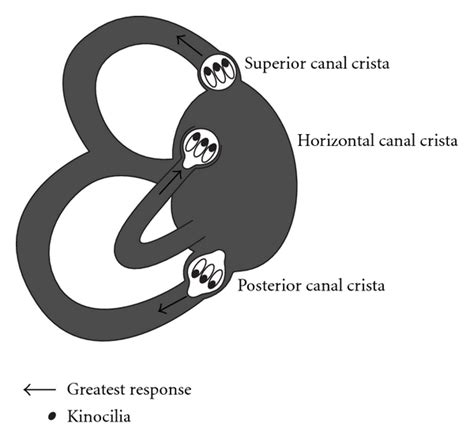 Benign Paroxysmal Positional Vertigo Bppv History Pathophysiology Office Treatment And