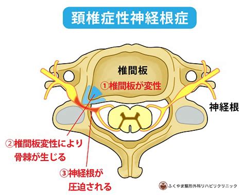 Neck Illustration ふくやま整形外科｜鹿児島市広木