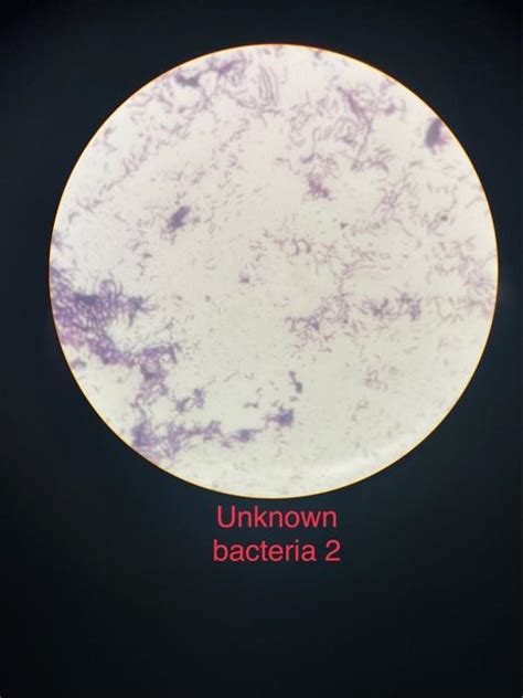 Solved 1)fill out the below table based on picture for two | Chegg.com 