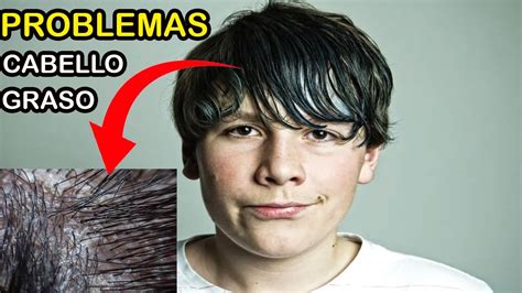 PROBLEMAS del CABELLO GRASO y COMO RESOLVERLOS J M Montaño YouTube