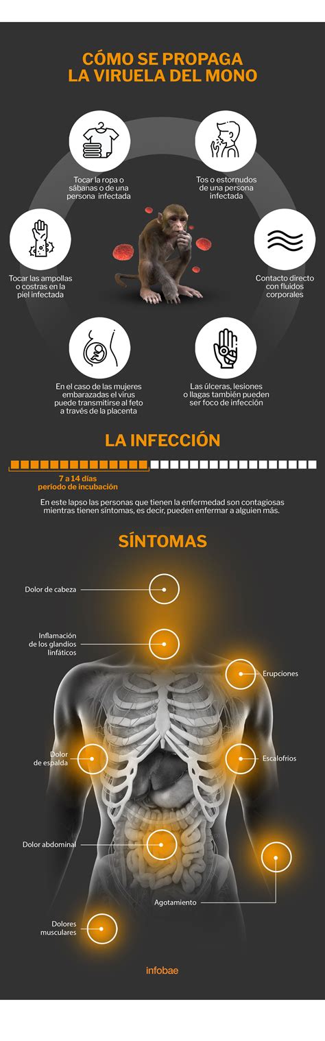 Síntomas Y Transmisión Qué Factores Llevaron A La Viruela Del Mono A Convertirse En Una