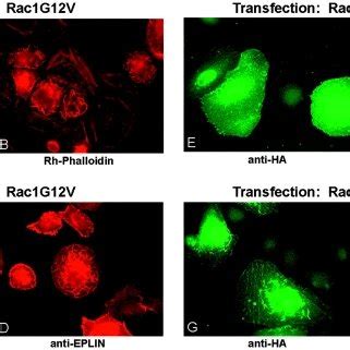 EPLIN Inhibits Membrane Ruffling Induced By Rac1 Transfected HeLa