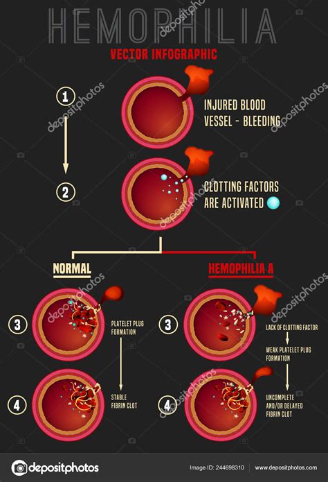 Different Types Of Hemophilia Diagram