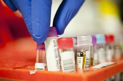 New Test To Improve Blood Cancer Treatment Pursuit By The University