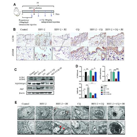 HSV 2 Infection Leads To A Blockage Of Autophagic Flux In Vivo And