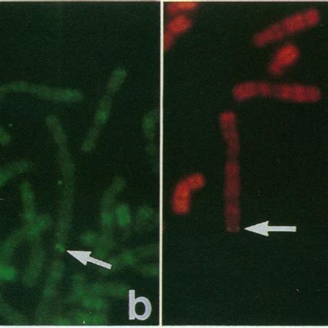 Chromosomal Localization Of The Human Irf Gene Shown Are Partial