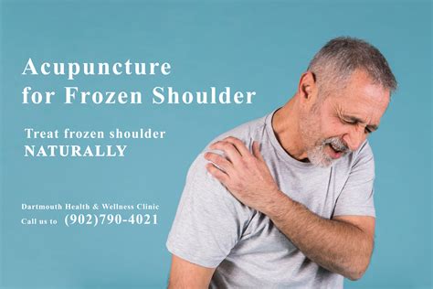 Acupuncture for Frozen shoulder