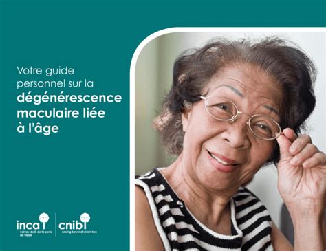 Votre guide personnel sur ladégénérescence maculaire liée