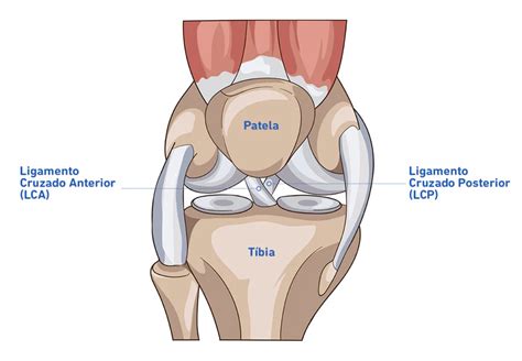 Lesi N Del Ligamento Cruzado Lca Y Lcp