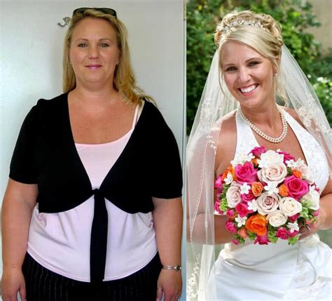 Bariatric Surgery Before After Stacey D The Weight Loss Surgery