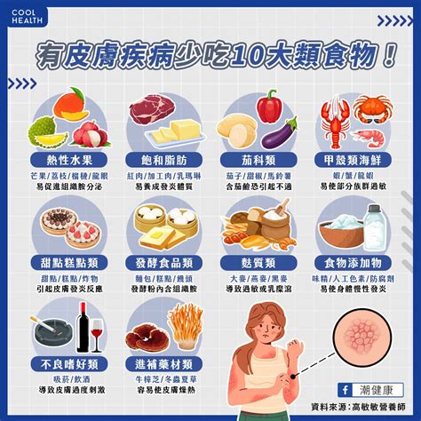 皮膚疾病好不了是「吃錯食物」害的？ 營養師揭「10大類飲食」讓濕疹症狀惡化 生活娛樂 Udn 女子漾