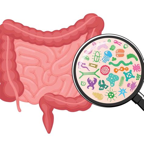 Research uncovers new information on gut microbiota and rheumatoid ...