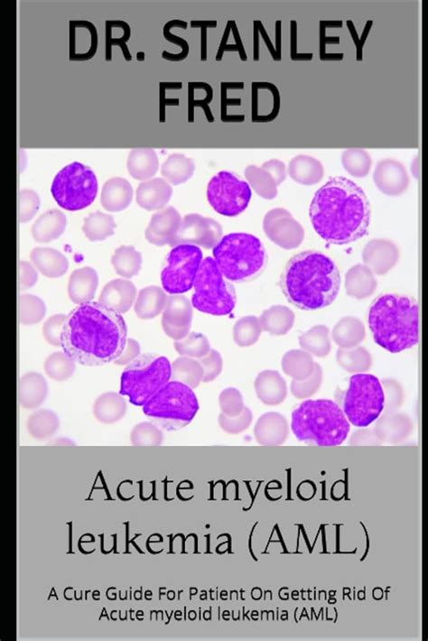 Table Iv From Classification Of Cell Types In Acute Myeloid 58 Off