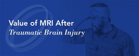 Value of MRI After Traumatic Brain Injury - Health Images