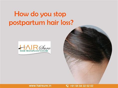 How Do You Stop Postpartum Hair Loss Hair Sure