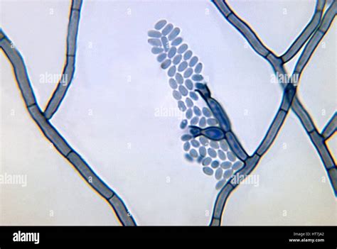 Photomicrograph of a conidia-laden conidiophore of a Phialophora ... 