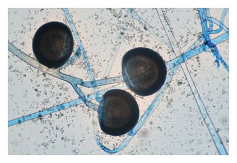 Sporangiophores with big sporangia, with no apophysis, rhizoids or ...