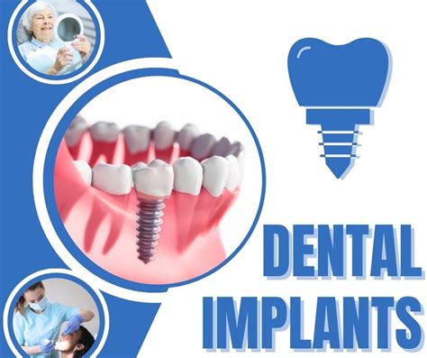 Bone Graft For Dental Implant Dr Darrell Kilcup