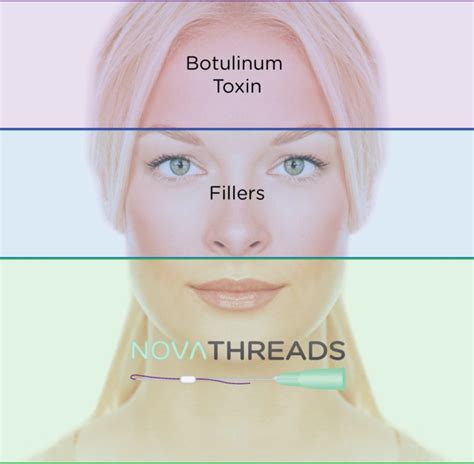 Novathreads Non Invasive Facelift Recovery Time Richmond Mclean