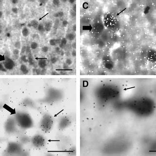 Photomicrographs Obtained Under Bright Field Illumination A B And D