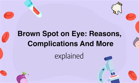 Brown Spot on Eye: Reasons, Complications And More