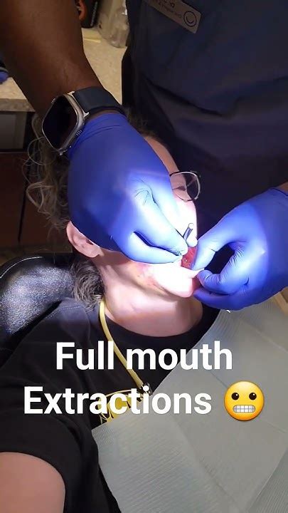 After Full Mouth Extractions 😬 Youtube