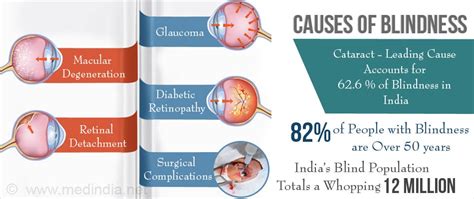 Causes of Blindness In India | Medindia