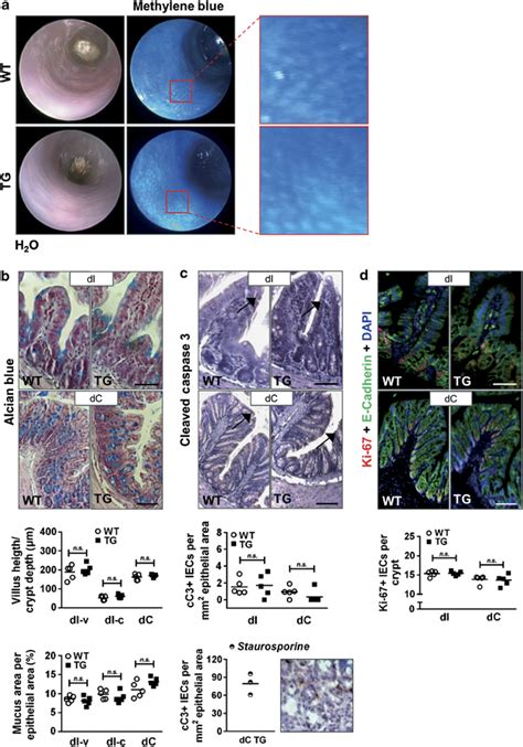 Chopiec Tg Tg Mice Do Not Spontaneously Develop An Inflammatory