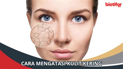 Cara Mengatasi Kulit Kering Dan Bersisik Secara Alami Biotifor