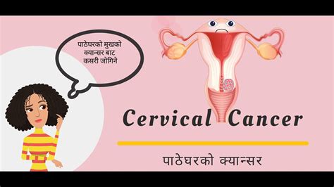 Cervical Cancer Causes Symptoms