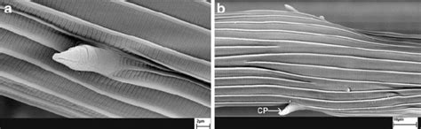 Scanning Electron Micro Graph Of O Occidentalis Showing Higher