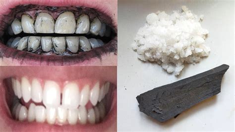 How To Whiten Teeth Instantly With Charcoal And Salt At Home Youtube