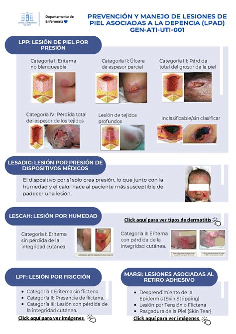 Clasificaci N Y Prevenci N De Lpad Lpp Lesi N De Piel Por Presi N