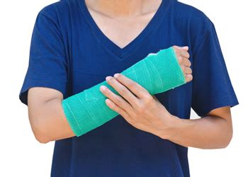 Fractured Wrist Cast