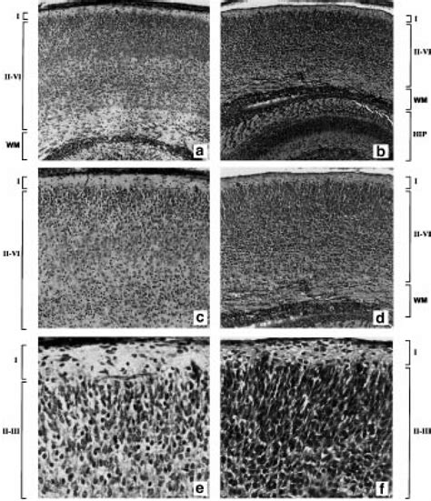 Cresyl Violet Stained Coronal Sections Of Cortical Layers IVI And The